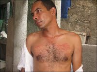 Darsi Ferrer, el digno médico cubano, que fue acusado de Desobediencia Civil, otro caso de Peligrosidad Social.
